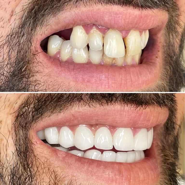 e-max livia med dental