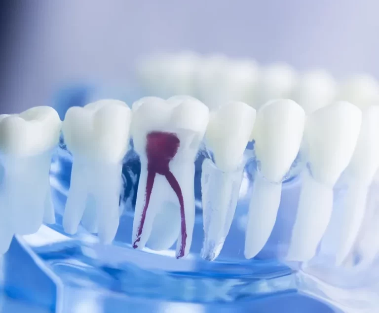 Endodonti Livia Med Dental